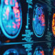 From satellites to medical scans: Tech transfer saves lives